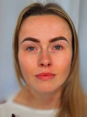 Eyebrow Micropigmentation