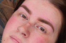 eyebrow-micropigmentation-1