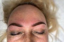 eyebrow-micropigmentation-6